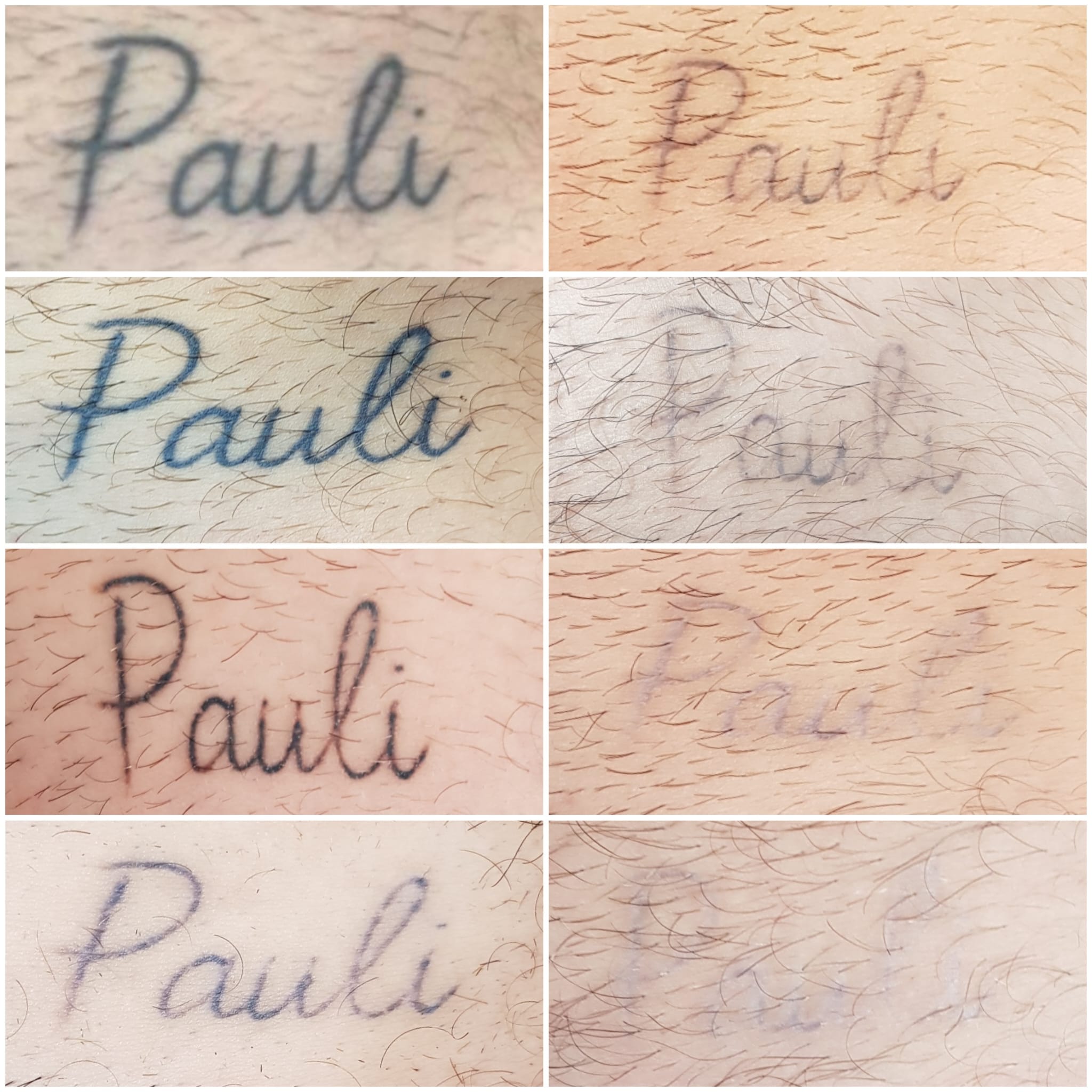 Tatto