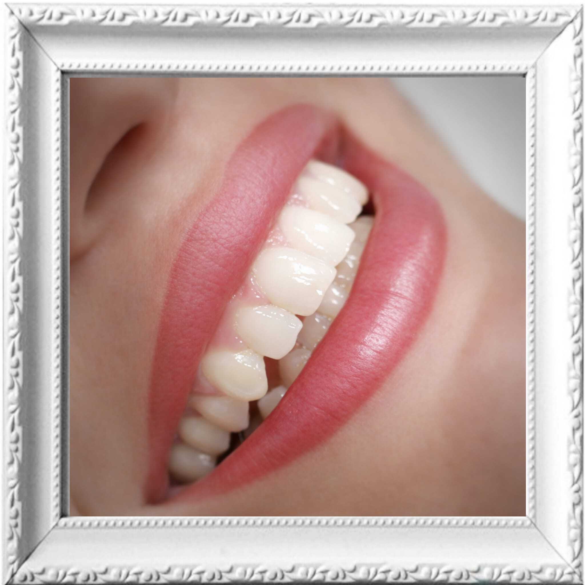 Labios